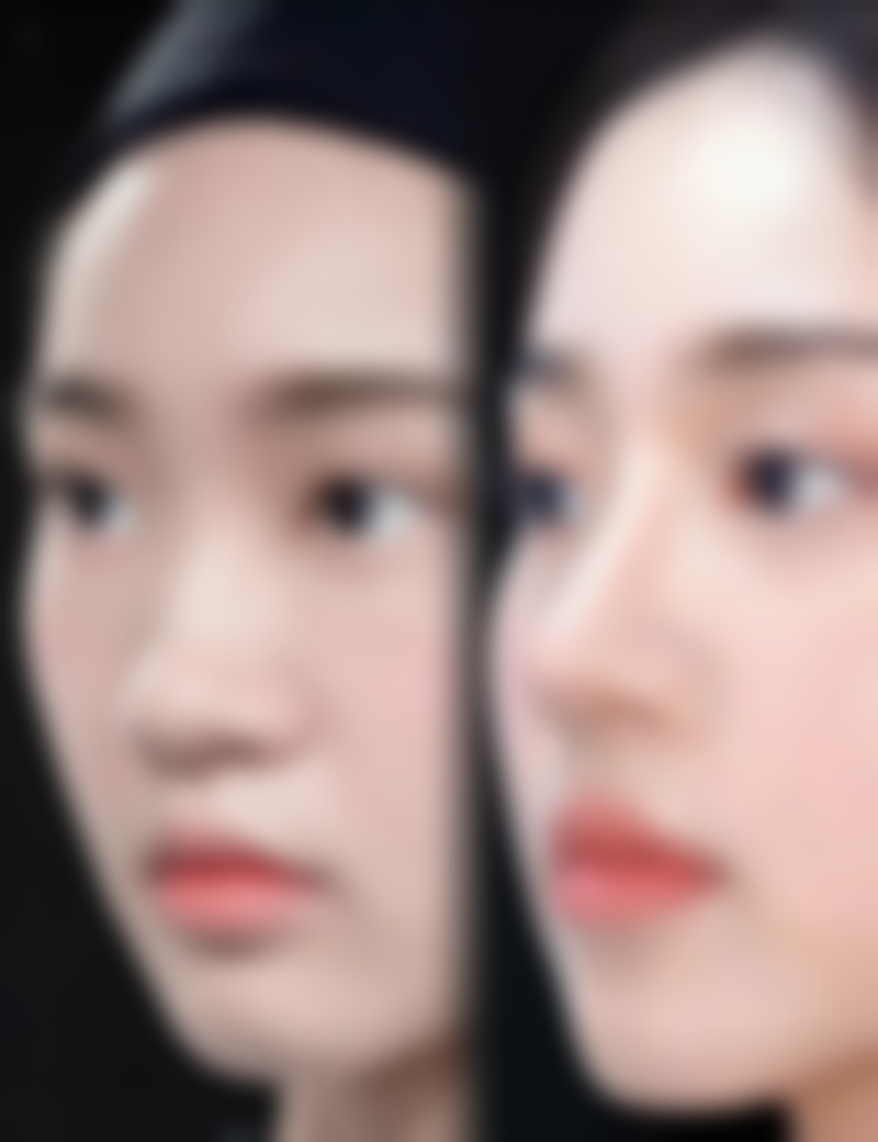 韩国365mc医院金大谦（大田院）医生技术好不好？