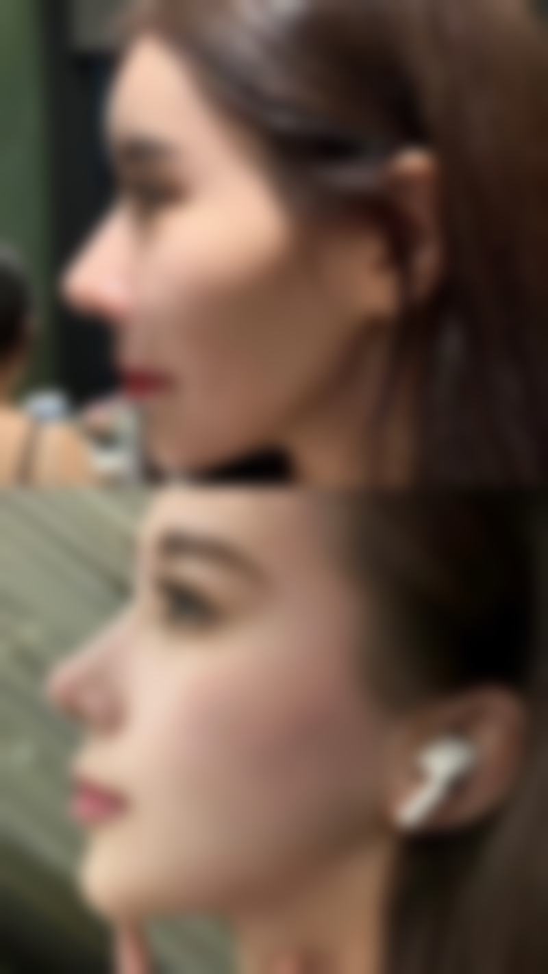 总结——廉江市人民医院烧伤整形外科怎么样？