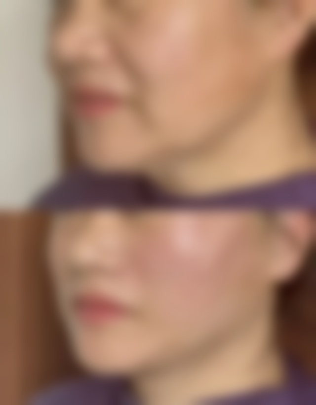 甘肃锦华美容医院收费标准参考