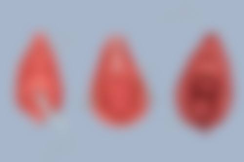 深圳吴波皮肤美容科诊所电话号码及预约方法