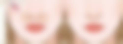 韩国daily整形外科皮肤科收费标准参考