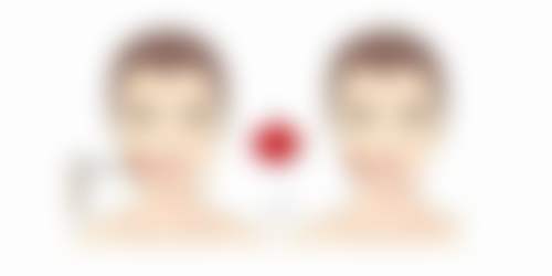 北京溪峰聚美仕整形医院刘向东医生口碑评价如何？