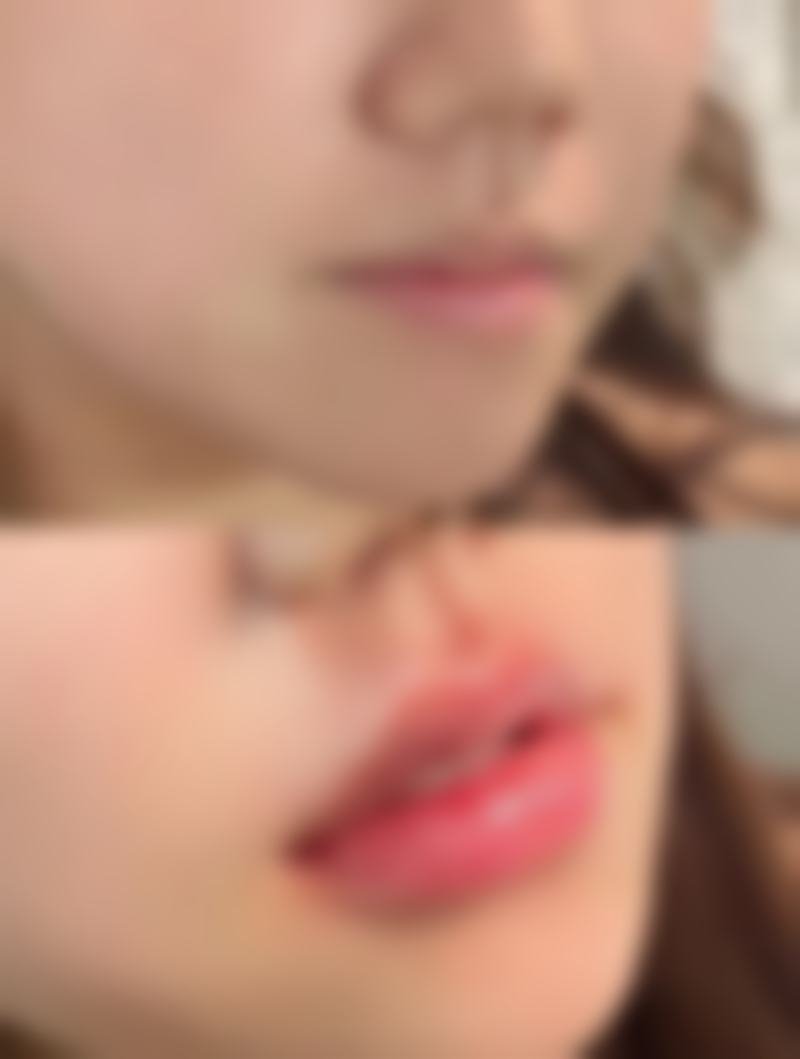 漳州第三医院(美容科)医院技术好不好？