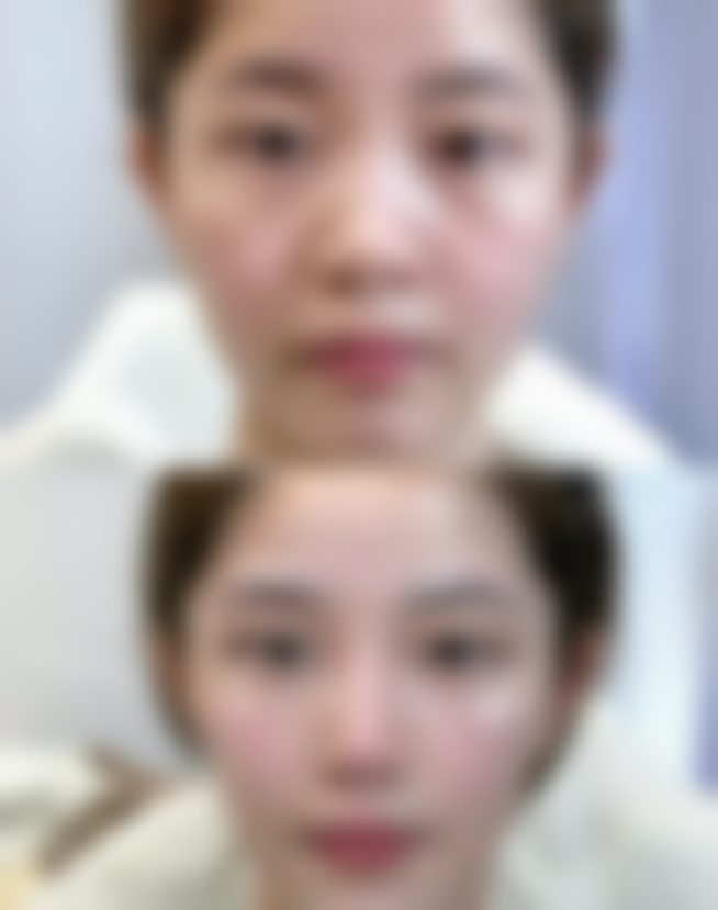 韩国枓翰整形外科电话号码及预约方法