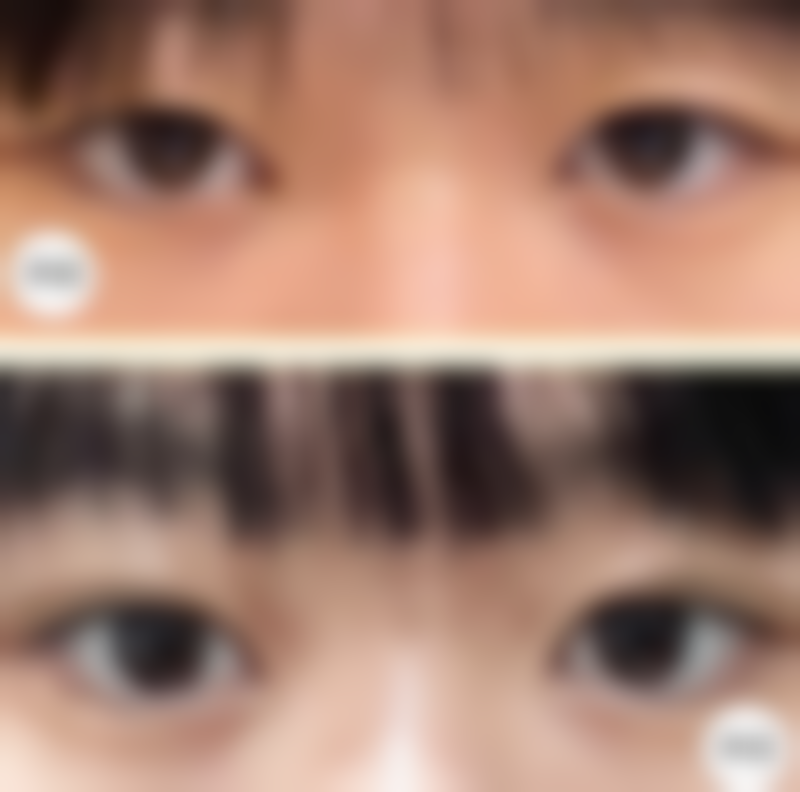 上海浦东新区摩尔齿科整形（曲阳路店）收费标准参考