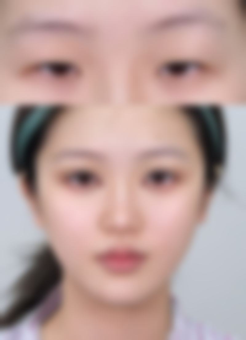 广州医 科 大学附属第三医院(整形美容科)韦婷医生技术好不好？