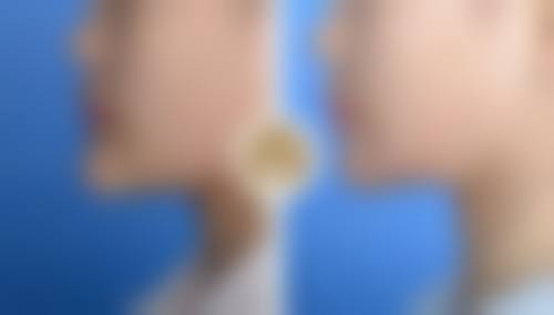 高邮吉丽生医疗美容诊所口碑如何？