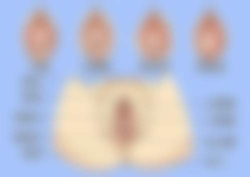 韩国(8)A特整容中 心金汉祚医生技术好不好?