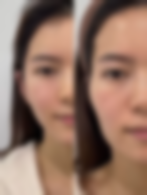 总结——韩国(8)A特整容中 心金汉祚医生怎么样?