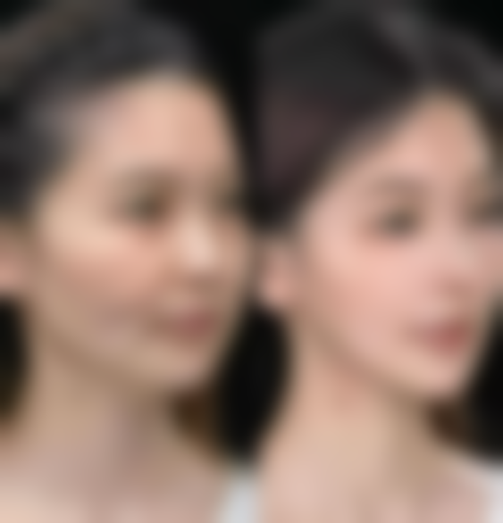 西安健丽医美口碑如何？