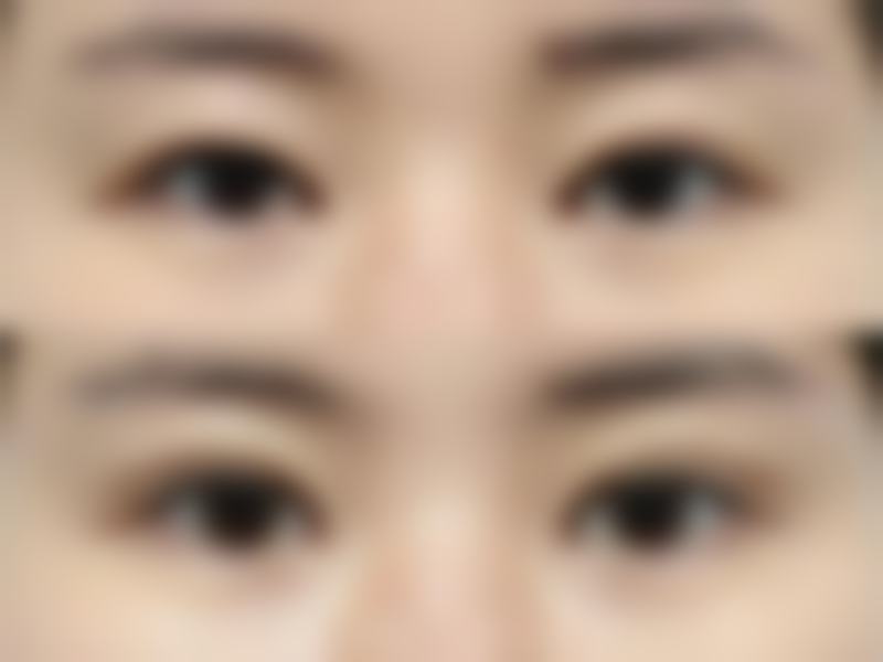 总结——呼和浩特熙颜整形怎么样？