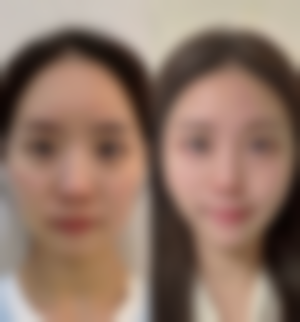 长沙壹希光合整形医院口碑如何？