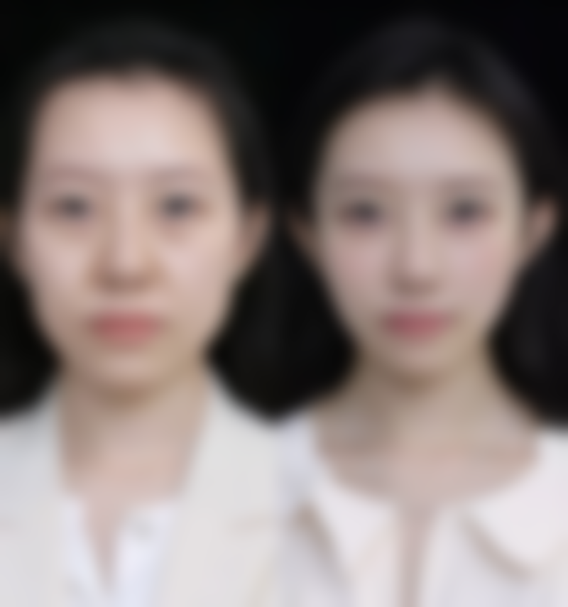 长沙壹希光合整形医院电话号码及预约方法