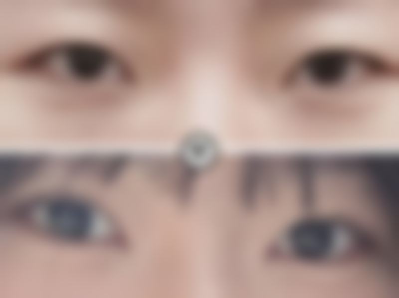 总结——西安罗敷宫医疗美容诊所怎么样?