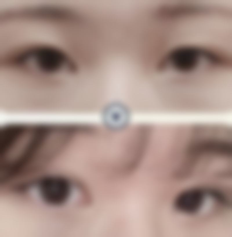 西安健丽医美医院技术好不好？