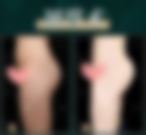 广州高尚医学美容中 心方锦平医生口碑评价如何？