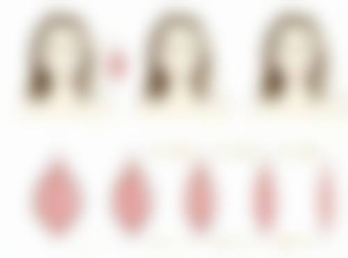 总结——武汉艾莱美整形医疗美容门诊部怎么样？