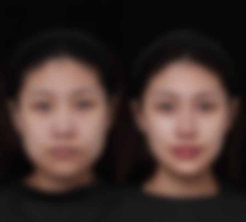 韩国365mc医院金河真（首尔院）医生口碑评价如何？