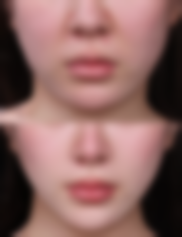 韩国365mc医院金河真（首尔院）医生挂号预约攻略