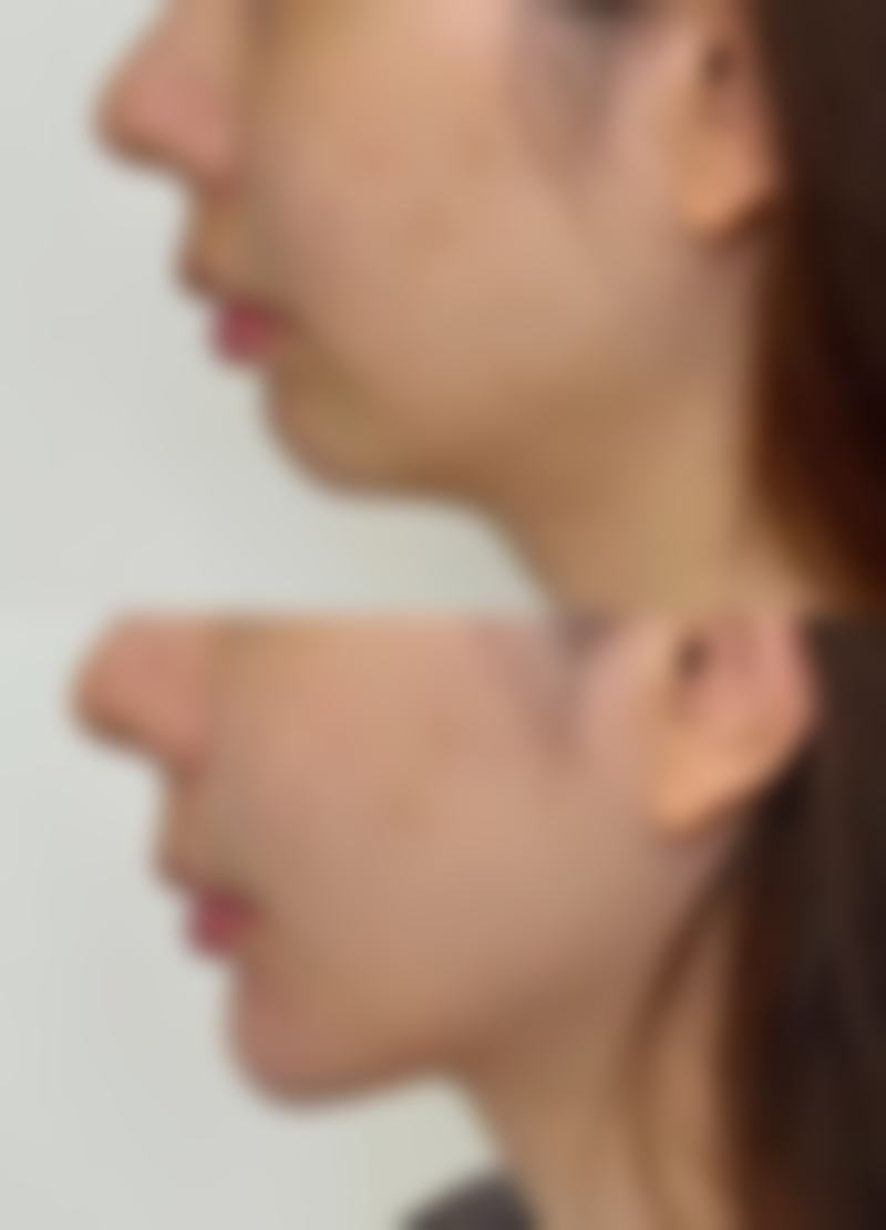 新余嘉和美容整形医院医院技术好不好？