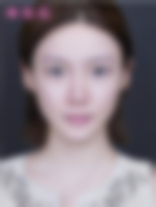 北京米兰柏羽丽都医疗美容医院于晓春医生口碑评价如何？