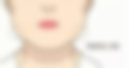 保定悦美医疗美容门诊部收费标准参考