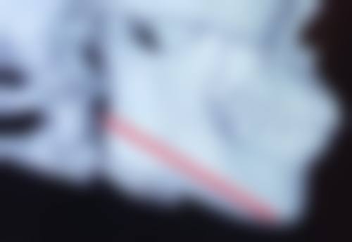 山东省立医院烧伤整形科王明青医生挂号预约攻略