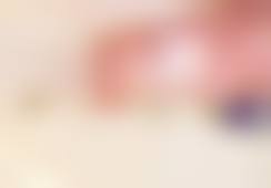 南宁悦美韩星医疗美容门诊部李姣医生技术好不好？