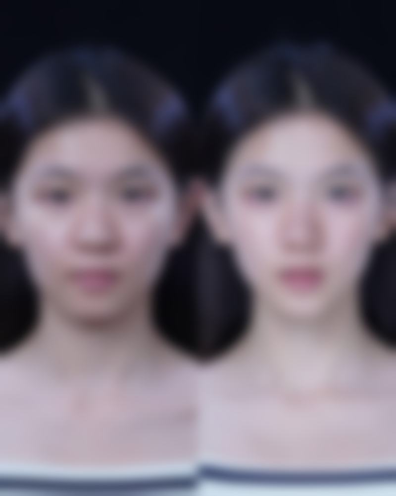 北京星颜医疗美容诊所硬件设备精良！