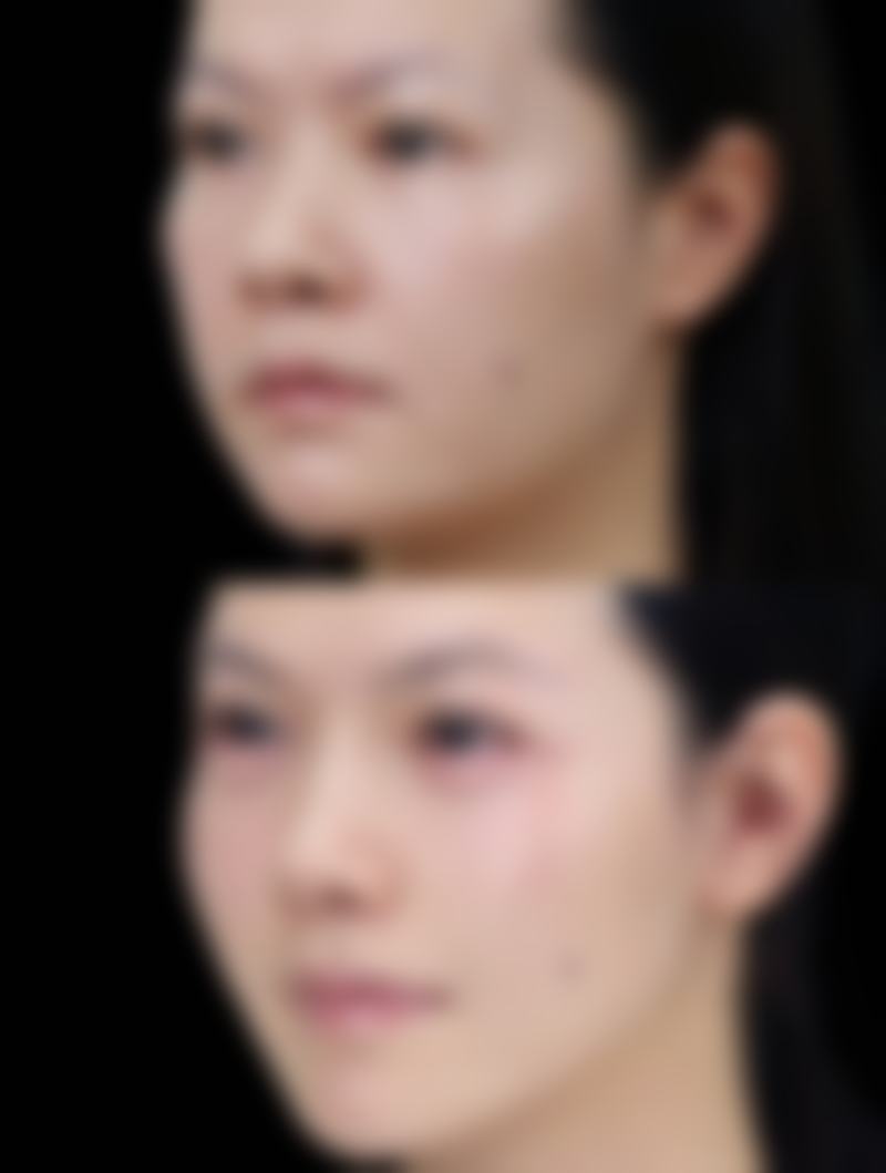 广州利美康粤美医疗美容门诊部任乐思医生挂号预约攻略