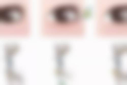 包头丽人妇产医院医学美容科梁月月医生技术好不好？