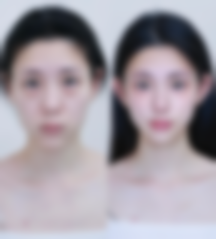 郸城褚氏中医皮肤病医院医院技术好不好？