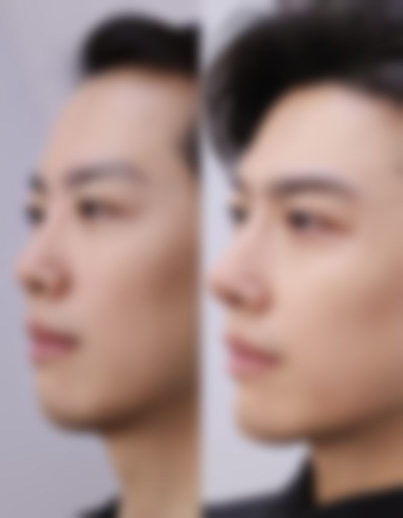 总结——荆州美颜伊森整形医院怎么样？