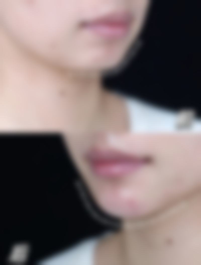 丹阳市人民医院整形外科口碑如何？