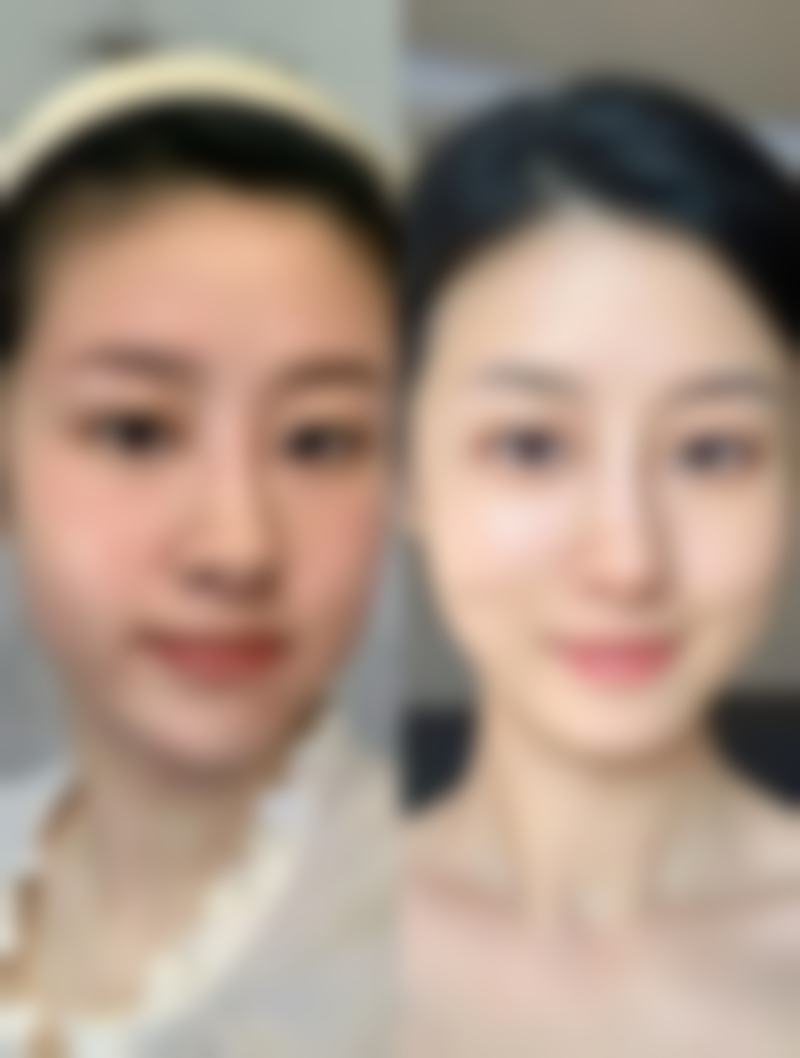 日本银座S美容形成外科医院口碑如何？