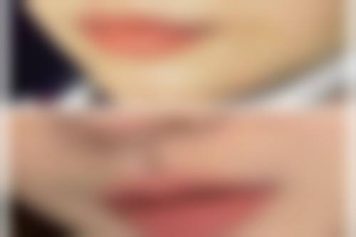 海口段碧辉医疗美容诊所段碧辉医生口碑评价如何？