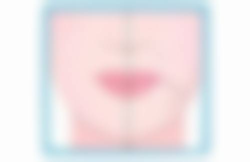 武汉施美尔整形医院王培杰医生技术好不好？