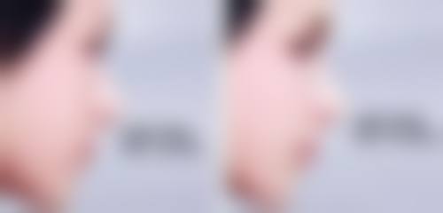 answer整形外科收费标准参考