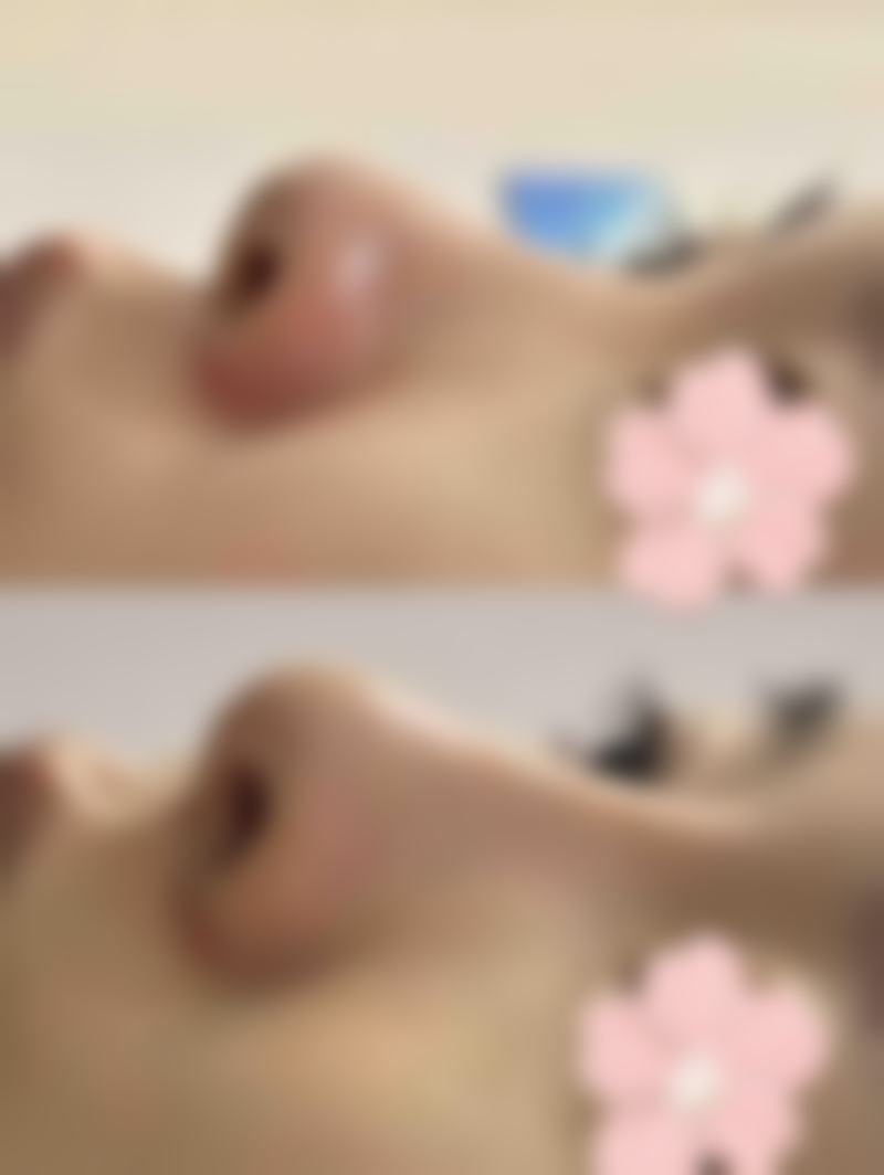 淮北微悦美莱坞整形医疗美容门诊部地址