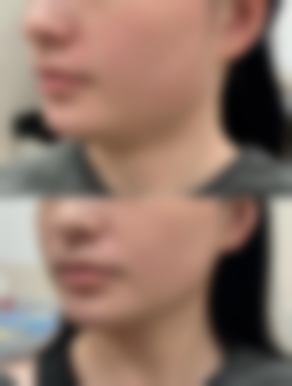 长沙开福碧莲盛整形医疗美容门诊地址