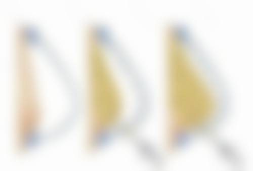 安阳苏莱美医疗美容医院医院技术好不好？