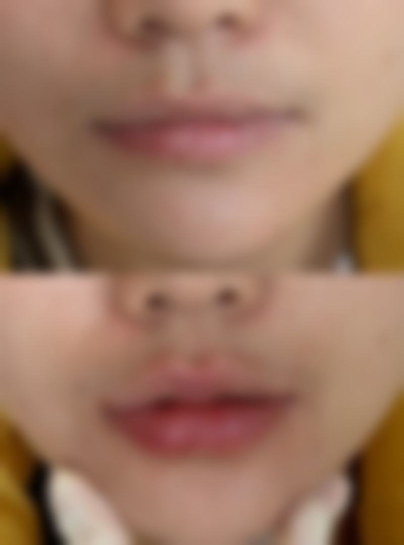 厦门大学医院整形美容科医院技术好不好？