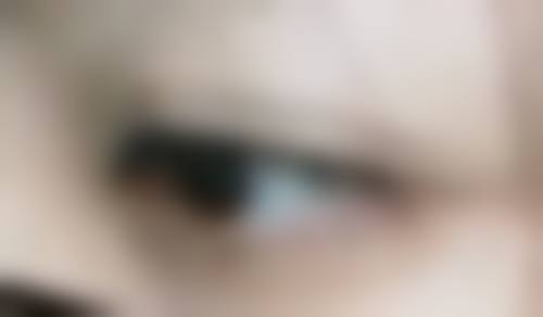 南充韩美整形美容医院邓丽华医生口碑评价如何?