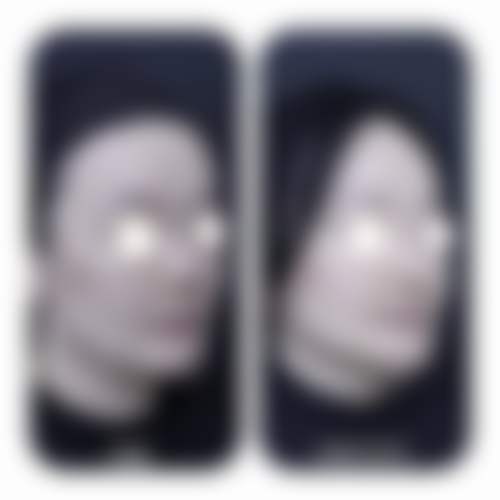 北京煤炭总医院医学美容整形中 心艾红梅医生技术好不好？