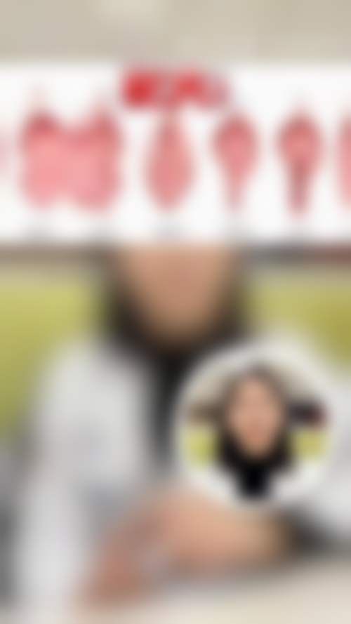 北京煤炭总医院医学美容整形中 心艾红梅医生口碑评价如何？