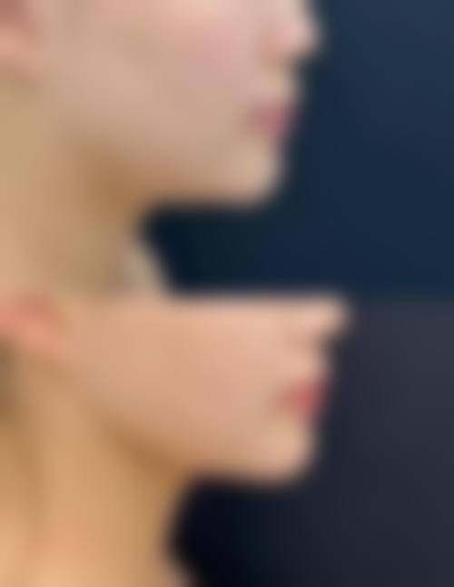 扬州雨辰医疗美容门诊部电话号码及预约方法