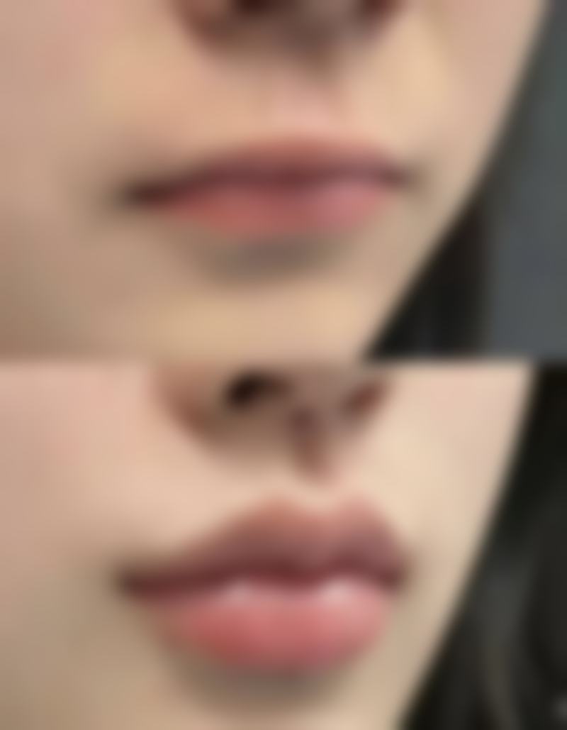 南充韩美整形美容医院邓丽华医生技术好不好?