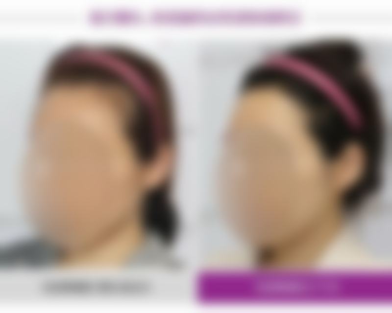 浙江杭州临湖门诊部(刘记整形)医院技术好不好?