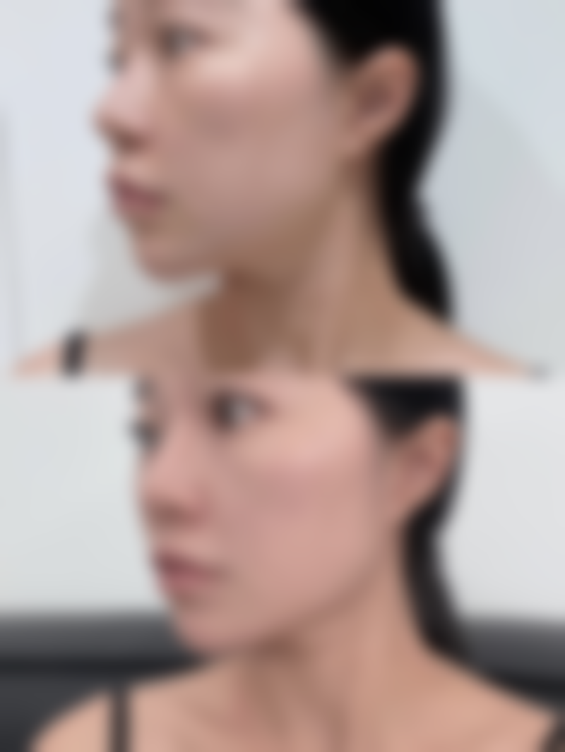 总结——凯里正美医疗美容门诊部怎么样?