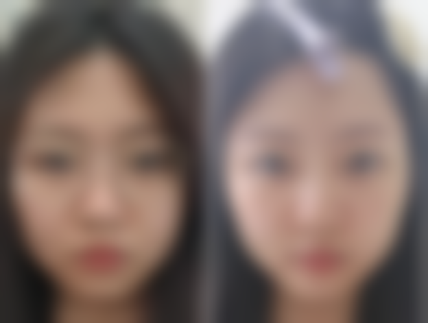 上海凯渥医疗美容医院技术好不好?